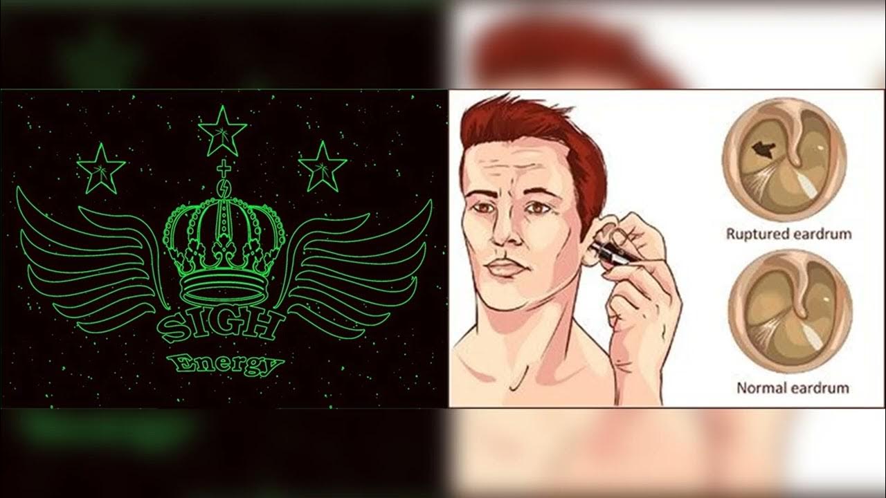 Eardrum Perforation Healing and Regeneration EXTREMELY POWERFUL