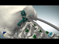 CASPIAN® Occipital Plate Product Animation