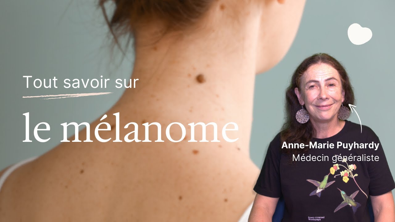 Mélanome : causes, symptômes, prévention - YouTube