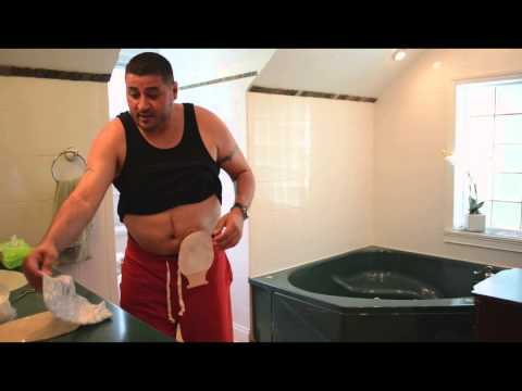 ostomates-swim-and-shower-worry-free.-no-leaky-stomas.