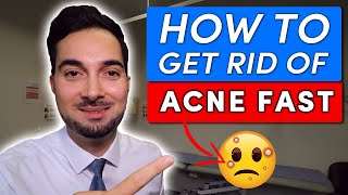 How To Get Rid Of Acne Pimples Fast Treatment