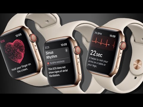 Kardiolog tester Apple Watch 4 - Kan klokka fange opp flimmer og infarkt?