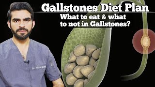 Gallstones Diet in urdu/ hindi