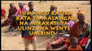 SUMANGO NA ULINZI WA WENYE UALBINO KATA YA MALANGALI