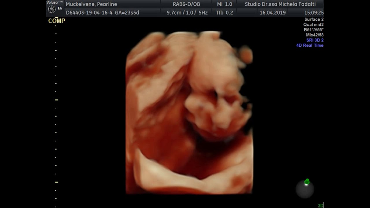 3d 4d Ultrasound 24 Weeks 6 Months Pregnant Youtube