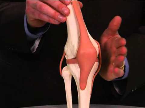 Video: Knee Fracture