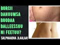 Borcii Balleessuuf Borcii Balleessuuf