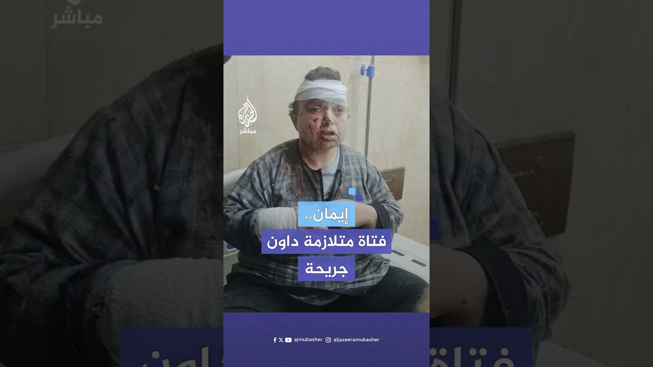 إيمان حمد.. فتاة تعاني من متلازمة داون أصيبت في قصف إسرائيلي استهدف مخيم النصيرات بغزة