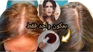 علاج تساقط الشعر نهائيا بمكون واحد فقط خلال اسبوع  اسرع طريقة لمنع التساقط وتطويل الشعر