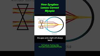 How eyeglass lenses correct Myopia