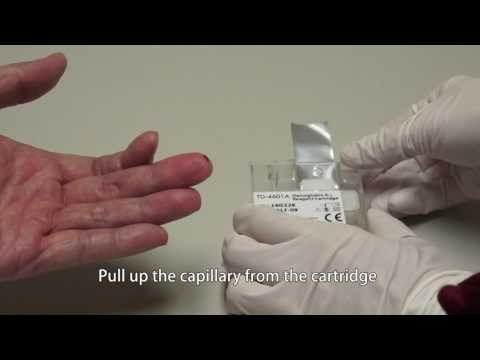 Xlofree A1c Test Walgreens 76