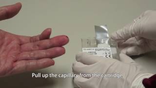 FORA A1C100 Hemoglobin A1c Auto Analyzer Introduction