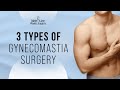 The 3 Types of Gynecomastia Surgery Explained by Dr. Raymond Jean