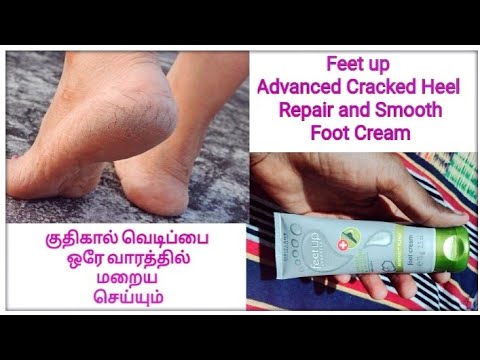 Feetup Advanced Cracked Heel Repair \u0026 