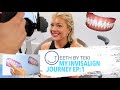 FINALLY FIXING WHAT'S BEEN BOTHERING ME, EP1: MY INVISALIGN JOURNEY WITH TEETH BY TEKI | AMY COOMBES