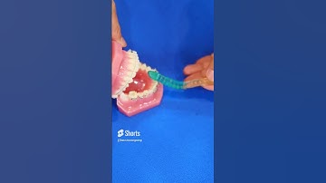 Đồ Ăn Nào An Toàn Cho Niềng Răng? Hãy Cùng Thử Với Kẹo Dẻo Nhé! |Dr Cường Official