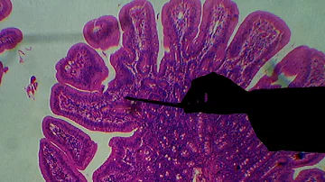 Como é classificado o tecido epitelial do intestino grosso?