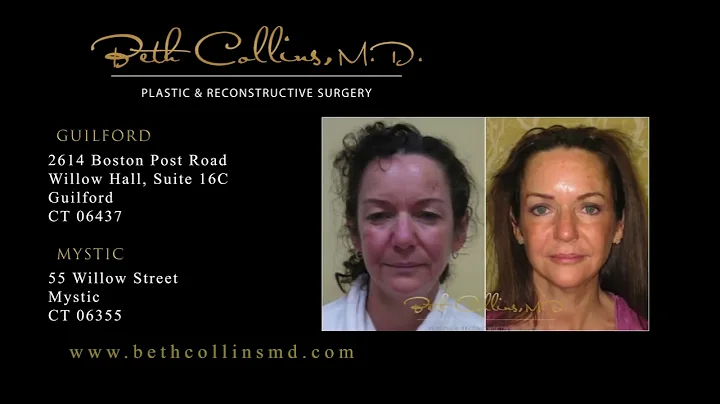 Guilford and Mystic, CT Plastic Surgeon Dr. Beth C...