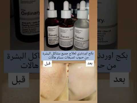 بنات طبعا اني اول مره انشر هنا عن منتجاتي اريد اشوف بي تفاعل لوتيوب حته استمر يورز النستا 