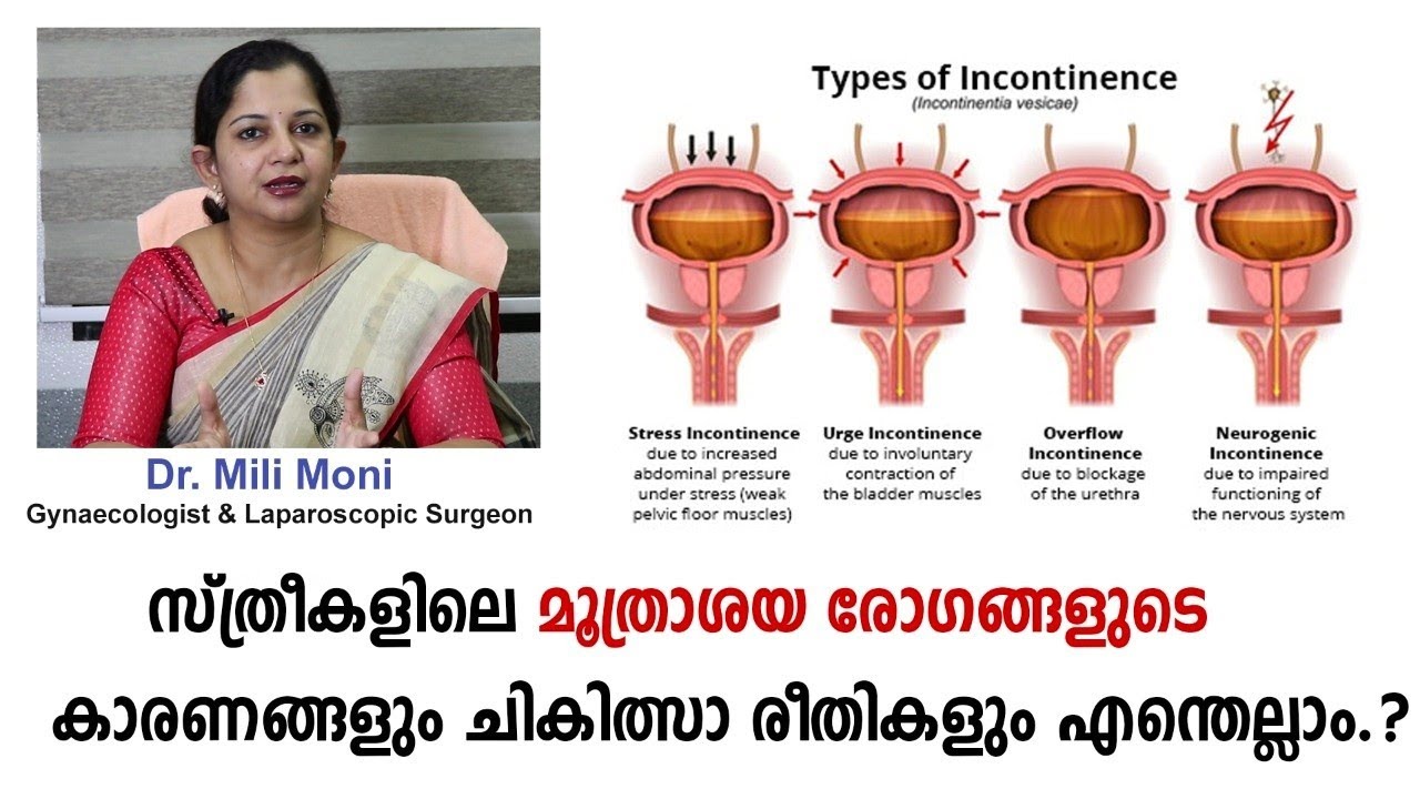 സ്ത്രീകളിലെ  മൂത്രാശയ  രോഗങ്ങൾക്ക് ചികിത്സ  എന്തല്ലാം? Dr. Mili  Mony  | malabar  hospitals
