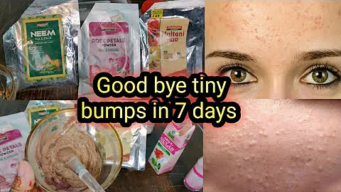 Clear tiny bumps from forehead & face |7 days clear skin challenge | remove pimples & tiny bumps