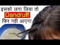 Dandruff कैसे हटाएं | Dandruff Treatment and Hair Growth Home Remedies