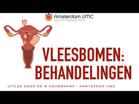 Video: Fibromen Van De Melkklier, Nodulaire Vleesbomen