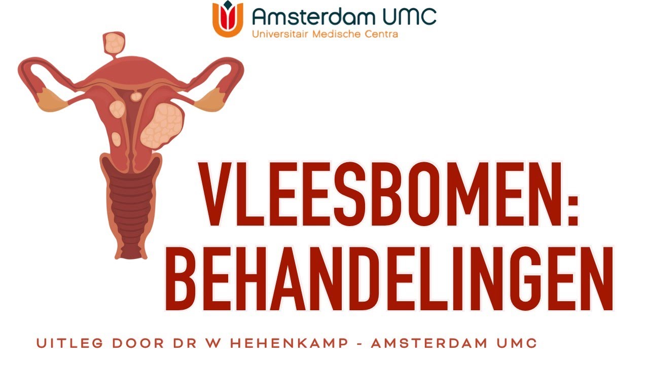 Amsterdam Umc Locatie Amc Myomen Vleesbomen