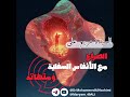 الصراع مع الأنفاس السفلية ومتاهاته السيدة مريم علي 