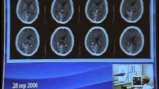 W-25 HISTORY OF LASER IN MEDICINE AND SURGERY IN RUSSIA screenshot 4