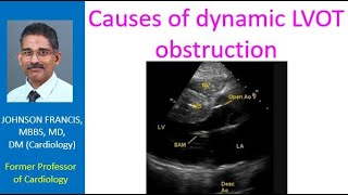 Causes of dynamic LVOT obstruction