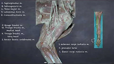 Canine Thoracic Limb Muscles, Nerves, Vessels Review