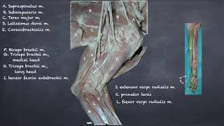 Canine Thoracic Limb Muscles, Nerves, Vessels Review