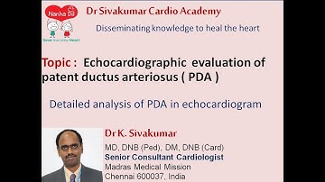 1/5 Echocardiographic evaluation of patent ductus arteriosus (PDA)