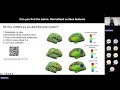 Neural Networks for Detecting Subtle Epileptogenic Lesions and Supporting Clinical Decision-Making