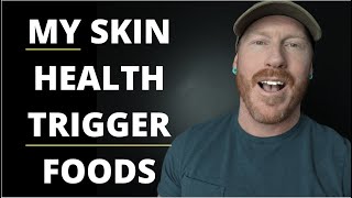 My 10 Worst Personal Skin Health TRIGGER FOODS (ECZEMA, DERMATITIS, PSORIASIS AND ROSACEA FREE)