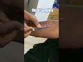 blood collection techniques #bloodsample #lab #sample #bloodtest #bloodcollection #nursing #shorts