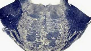 Doctor Brain Pontine Trigeminal Nuclei