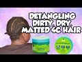 DETANGLING MY DIRTY, DRY, MATTED SHORT 4C HAIR USING JUST FOR ME DETANGLING TREATMENT