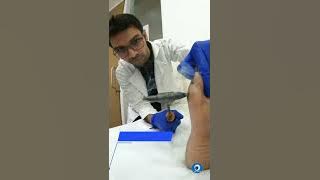 How to Remove Corn In Just 10 Seconds | Remove Corn & Calluses Without Anesthesia & Without Medicine
