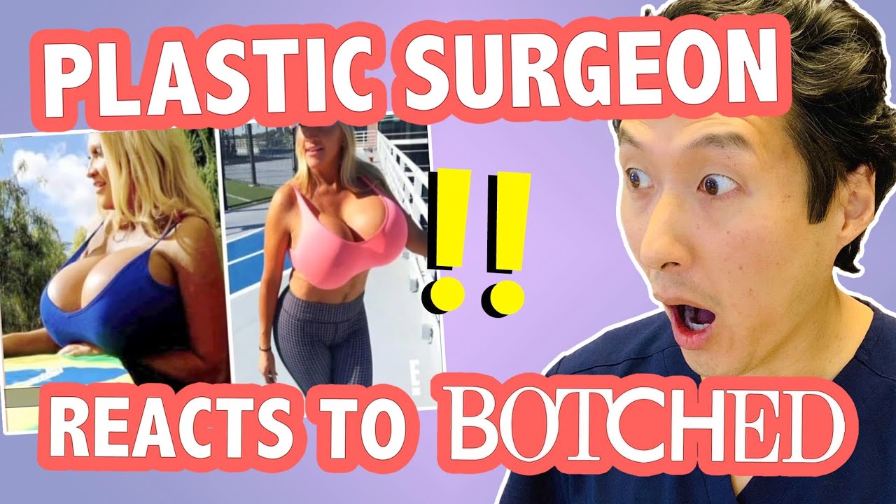 The Largest Breast Implants Ever Plastic Surgeon Reacts To Botched Youtube