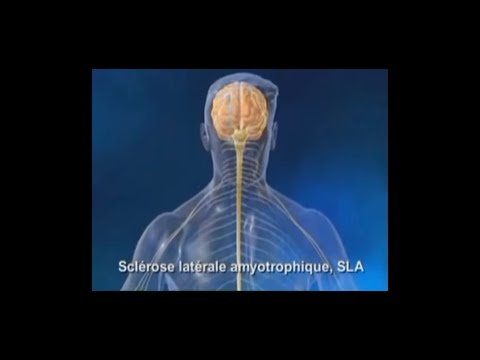 Vidéo: Qu'est-ce que la maladie du motoneurone ?