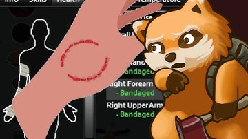 What to do When You Get Bitten in Project Zomboid