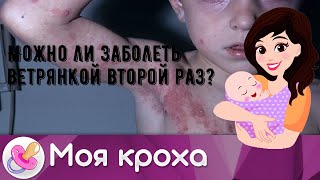 Можно ли заболеть ветрянкой второй раз?