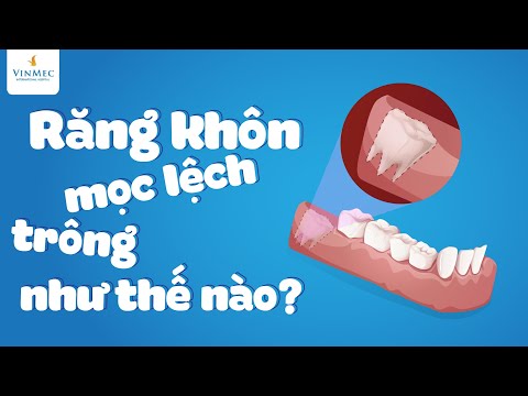 Video: Răng Mọc Như Thế Nào