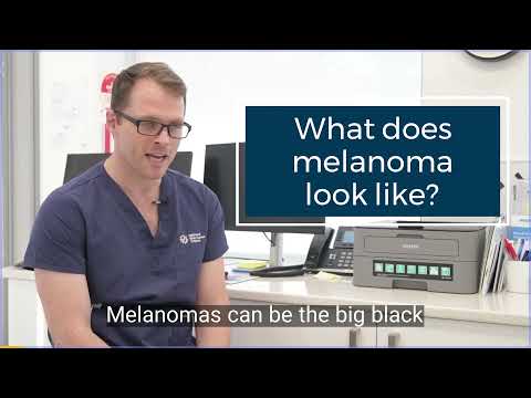 What does melanoma look like?