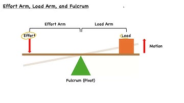Understanding Levers - iPREP