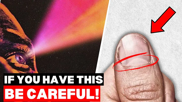 The Secret Spiritual Meaning Of A “Half Moon” On Your Thumb Nail