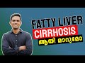 Fatty liver  cirrhosis    ii episode 01 ii dr sijil ii fattyliver cirrhosis