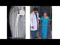 Joint replacement specialist  ongole  dradarsh kota